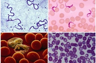 quais parasitas podem estar no sangue humano