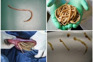 quais parasitas podem viver no intestino humano